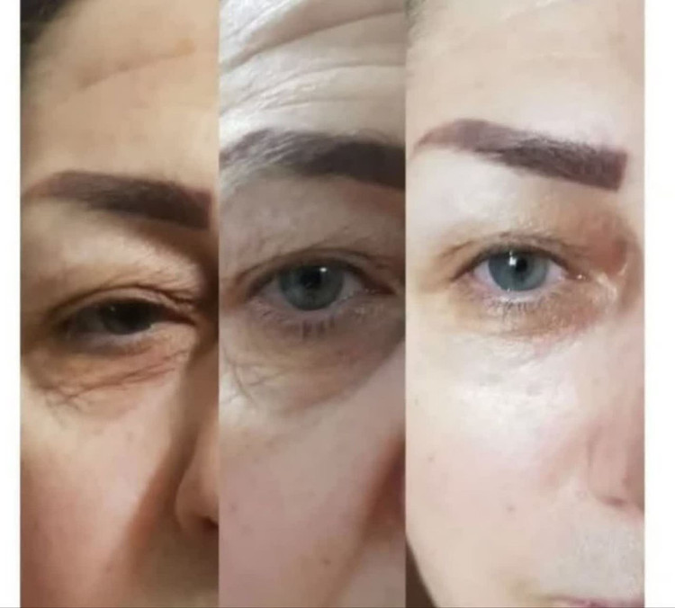 کرم لیفتینگ پوست ۱۲۰ میل لاکچری کوین( نمایندگی اصلی )